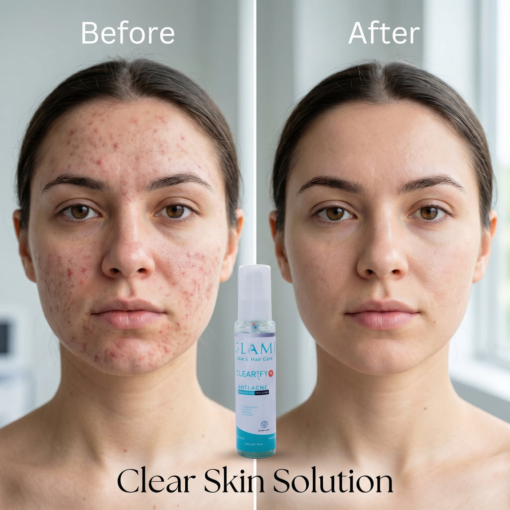 Clearify Anti-Acne Face Wash – Salicylic Acid Deep Cleansing Formula