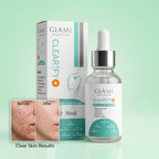 GLAMI Clearify+ Anti Acne Serum 30ml – Salicylic Acid &amp; Oil Control Formula