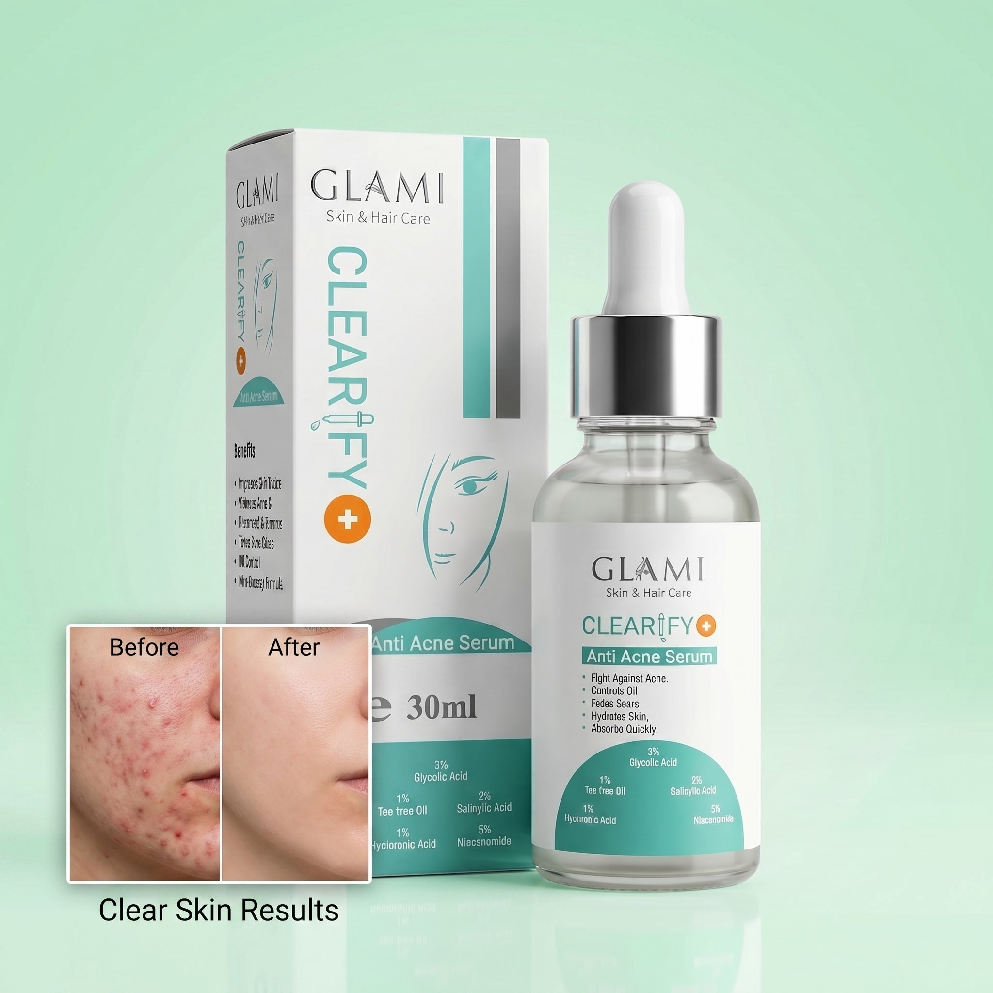 GLAMI Clearify+ Anti Acne Serum 30ml – Salicylic Acid &amp; Oil Control Formula