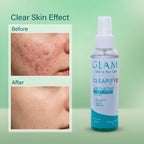 GLAMI Clearify+ Toner Spray SPF – Oil Control, Pore Refining &amp; UV Protection Mist