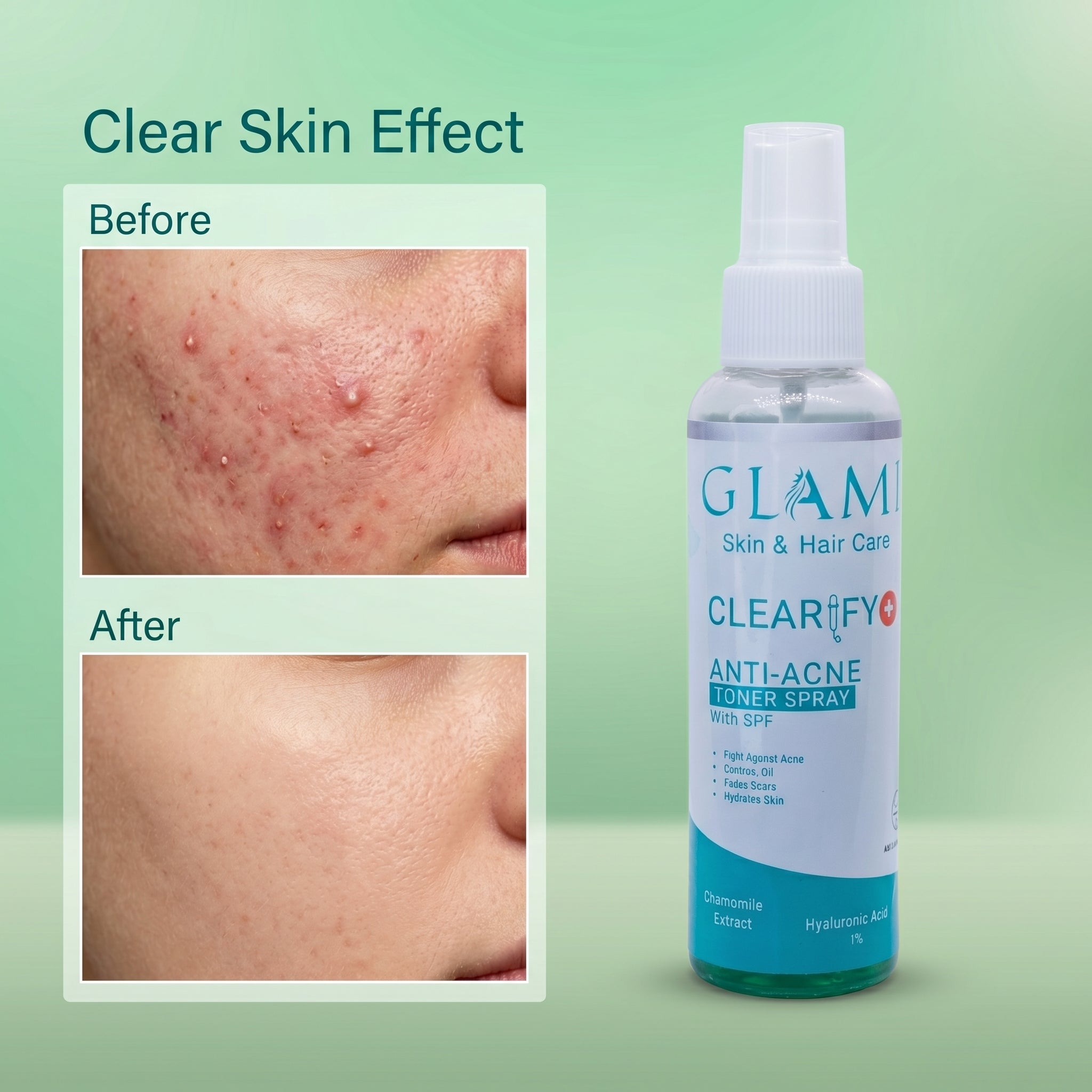GLAMI Clearify+ Toner Spray SPF – Oil Control, Pore Refining &amp; UV Protection Mist